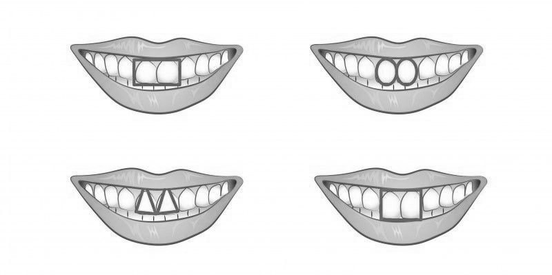 Diş Estetiği Uygulamaları Nasıl Yapılır?