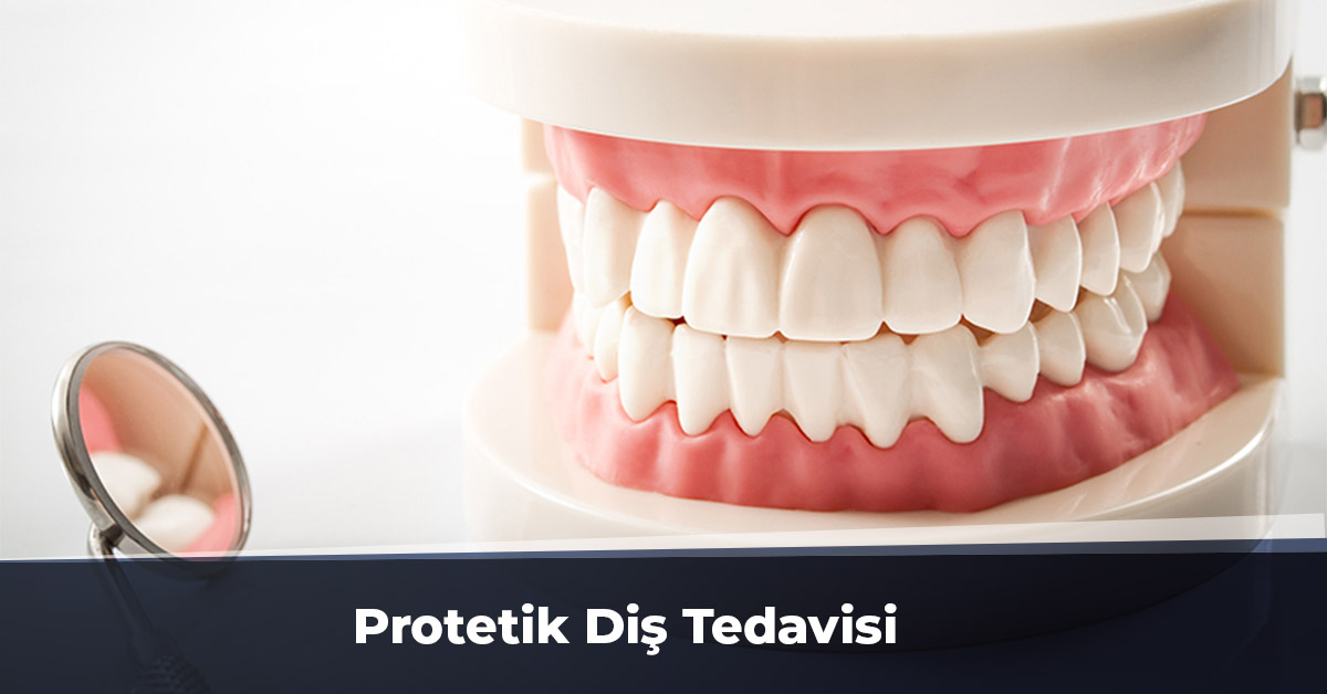 Protetik Diş Tedavisi Ankara