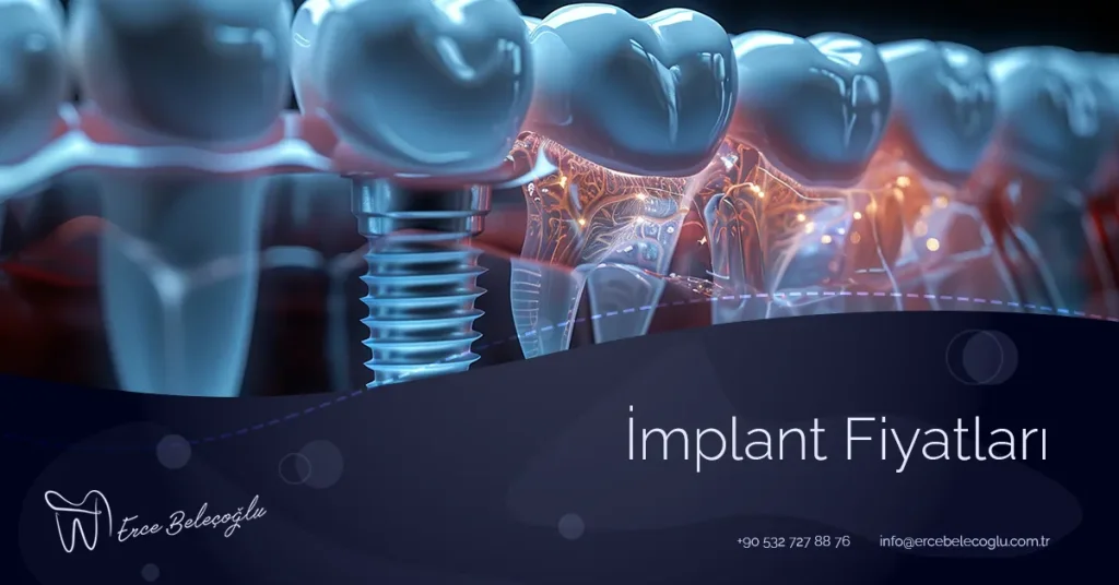 İmplant Fiyatları