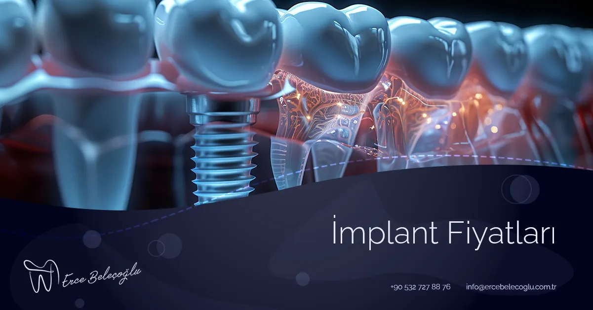 İmplant Fiyatları