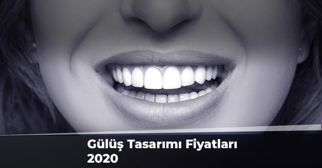 Gülüş Tasarımı Fiyatları 2020