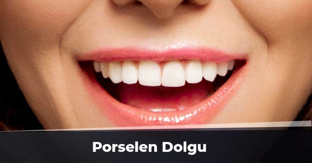 Porselen Dolgu