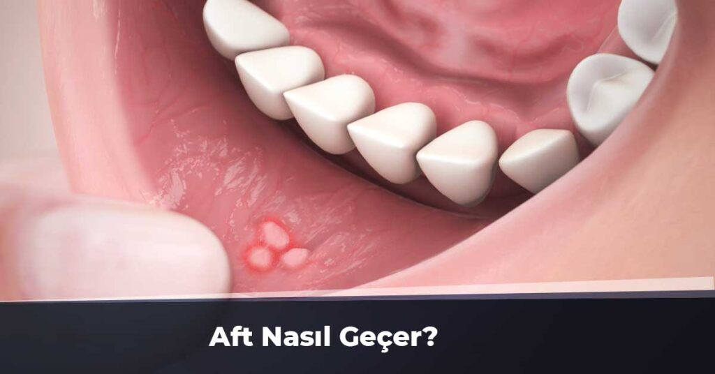 Aft Nasıl Geçer?