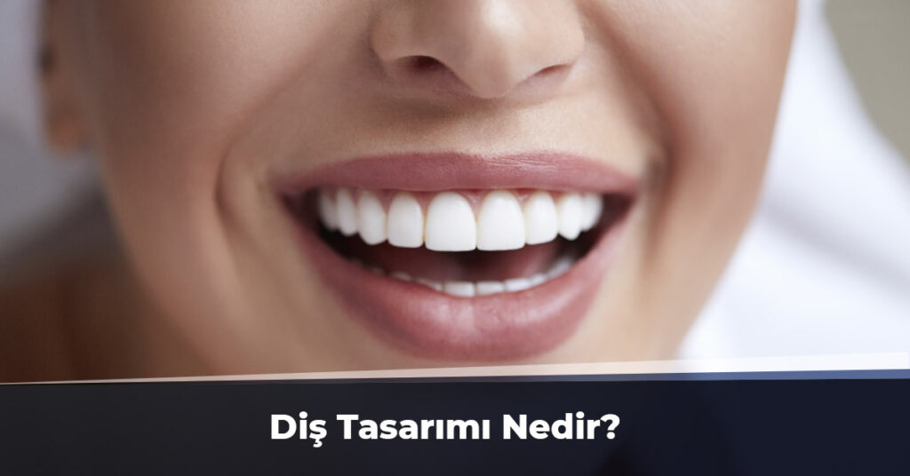 Diş Tasarımı Nedir?