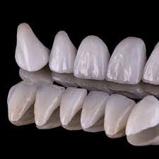 Diş Tasarımı Nedir?