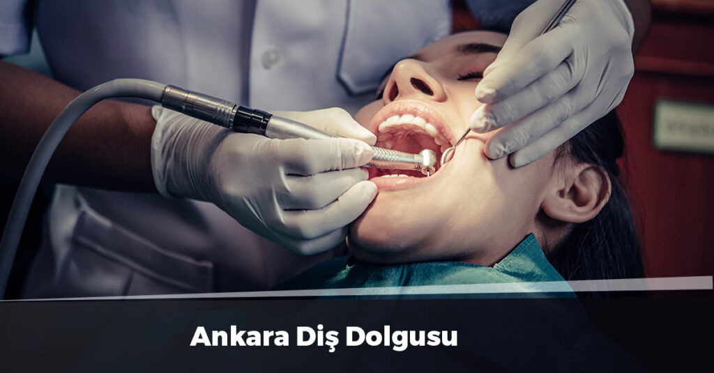 Ankara Diş Dolgusu