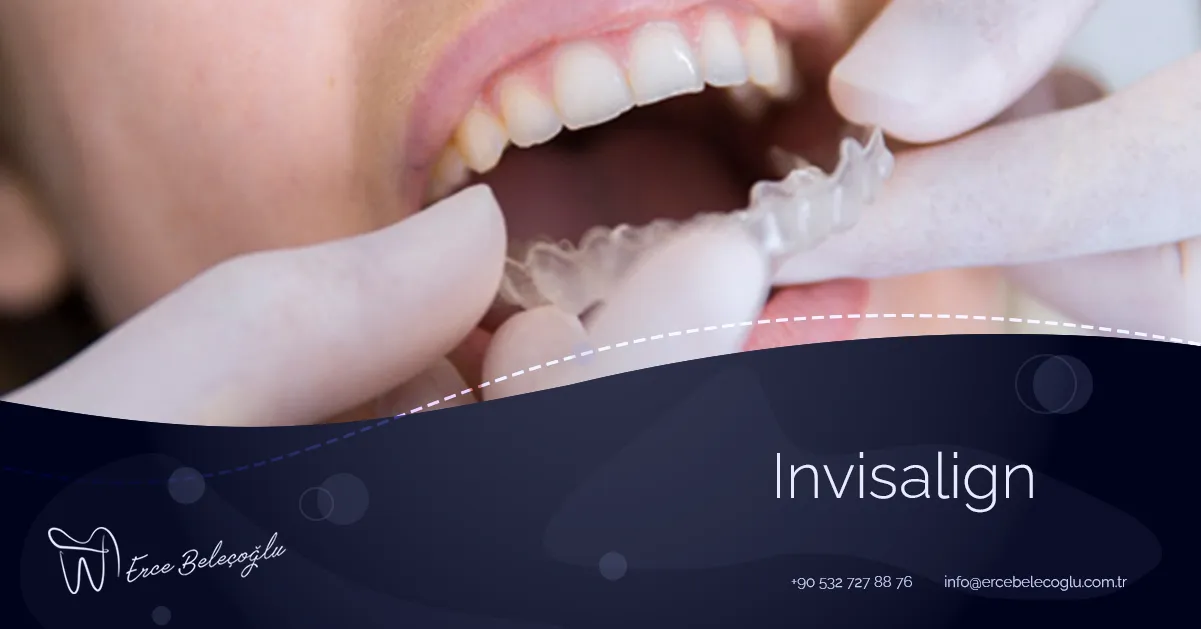 Invisalign Ankara