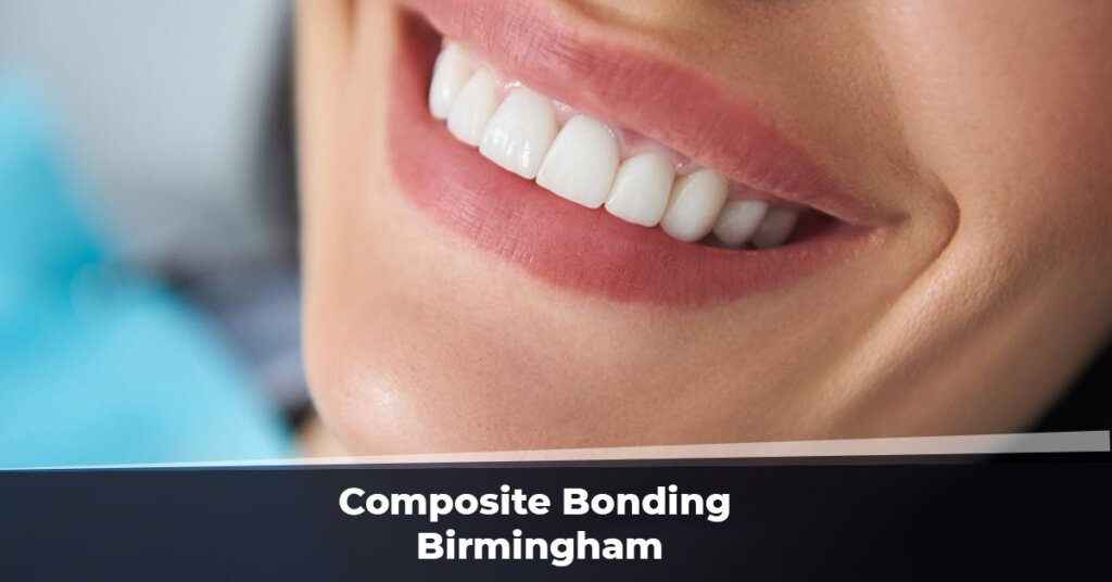Composite Bonding Birmingham
