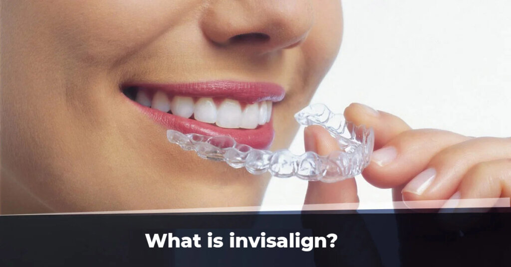 What is invisalign? - Invisalign - Erce Beleçoğlu