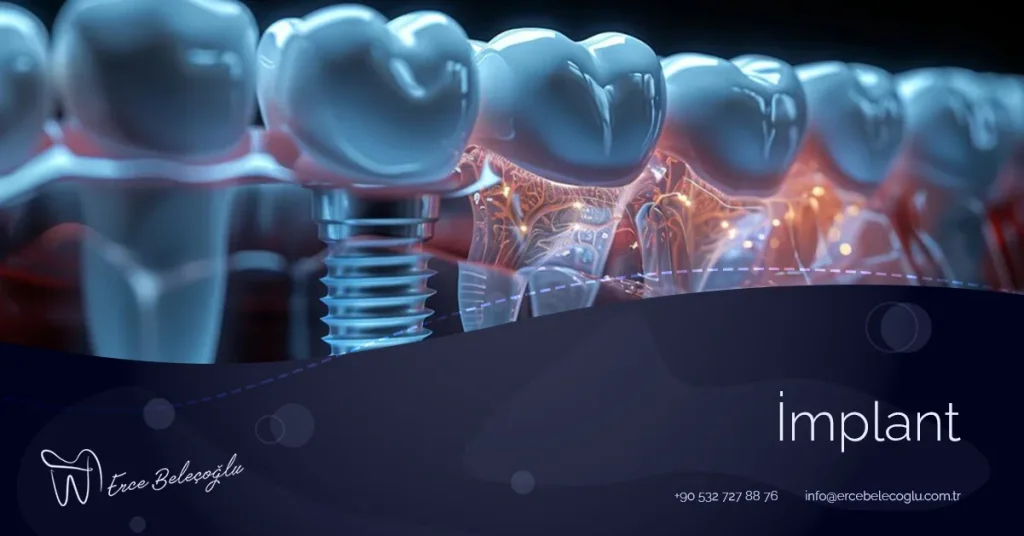 İmplant Fiyatları
