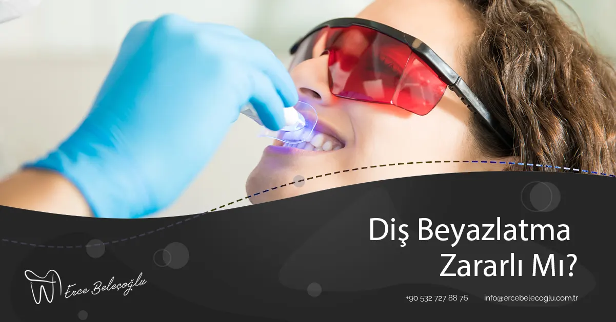 diş beyazlatma zararlı mı 001