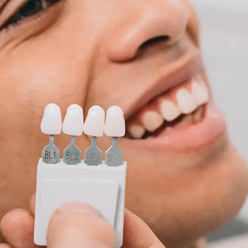 Ankara zirkonyum kaplama 002