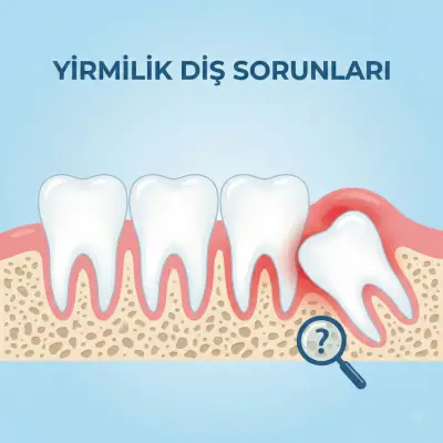 Yirmilik Diş Sorunları