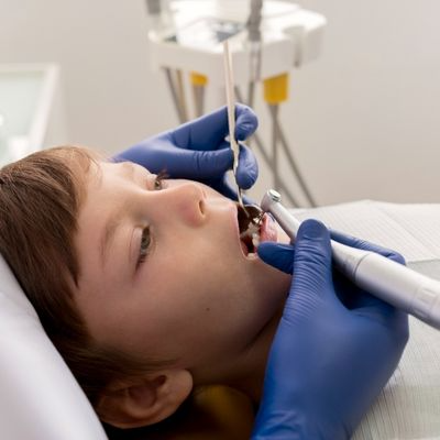 Çocuklarda Kanal Tedavisi