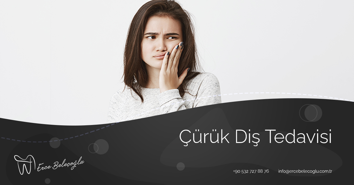 Çürük Diş Tedavisi
