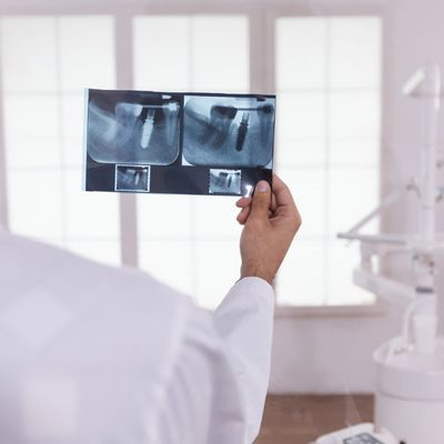 Diş Tomografisi